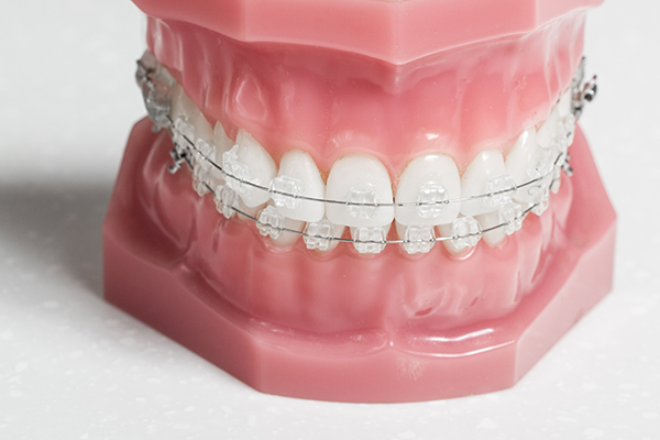 clearbrace600400